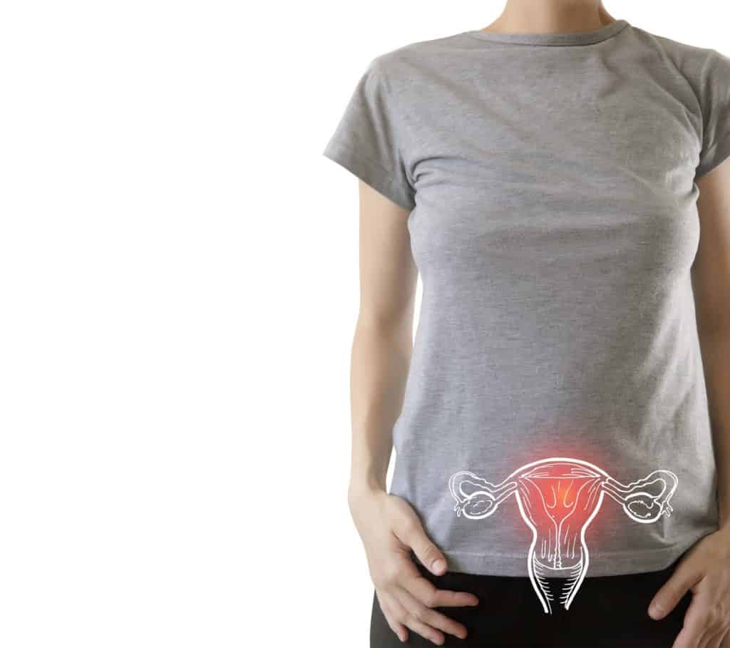 representation of ovarian cancer zone