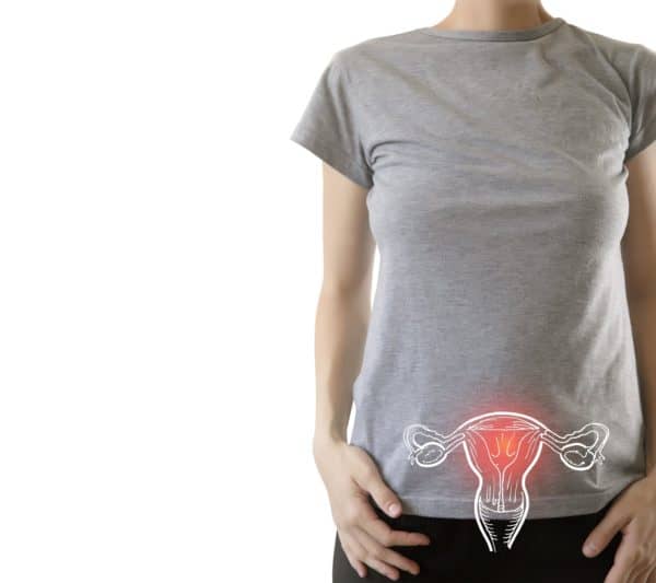 representation of ovarian cancer zone