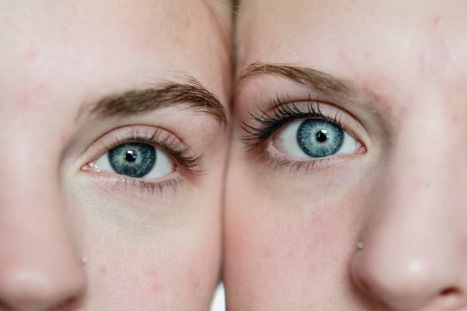 two ladies after visiting a dermatologist