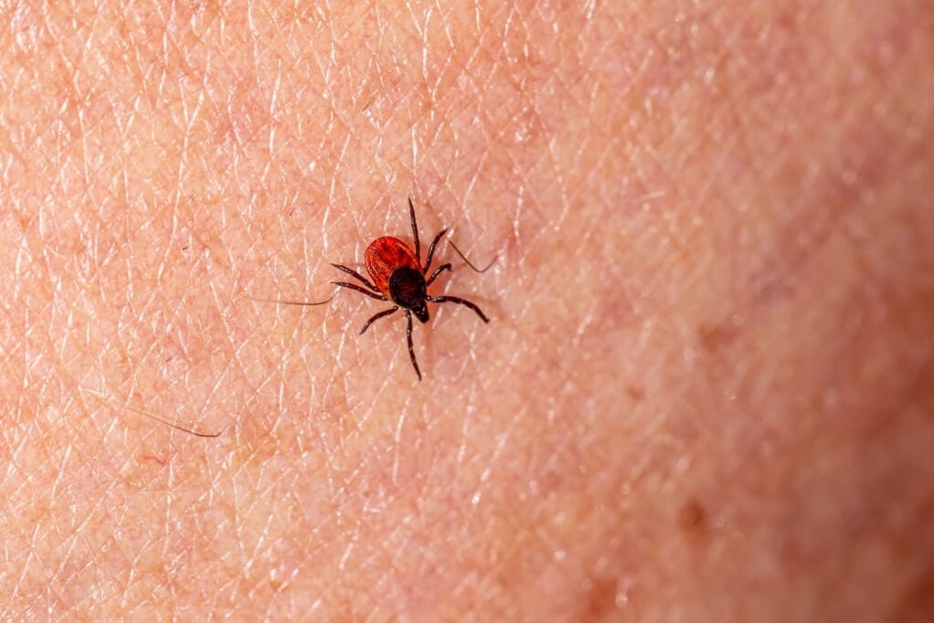 Deer tick on skin